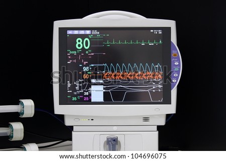 ECG