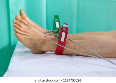 Ecg Ekg Legs Man Electrodes Electrocardiogram Stock Photo 1127703524 ...