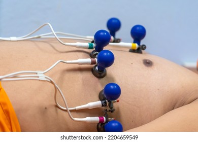 ECG Or EKG Of Man With Electrodes For Electrocardiogram Records On Bed In Hospital.