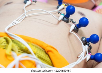 ECG Or EKG Of Man With Electrodes For Electrocardiogram Records On Bed In Hospital.