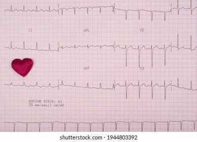 ECG Graph  With A Heart. Rhythm Strip.