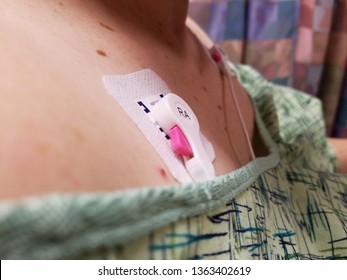 ECG Leads Patient Hospital Gown