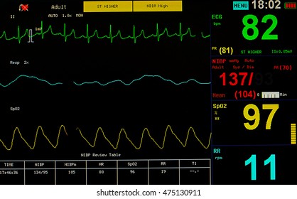 Vital Sign On Monitoring Device Medical Stock Photo (Edit Now) 1414771259