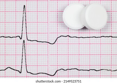 ECG. Myocardial Ischemia On The ECG And Pills Nearby.Angina.Chest Pain.Close-up