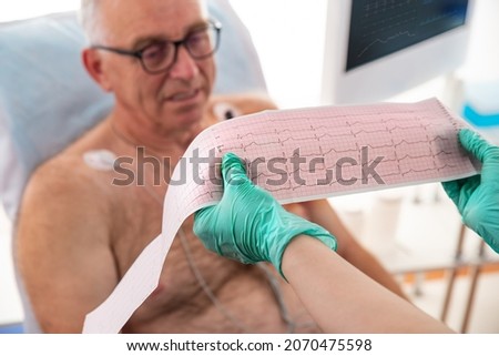 ECG showing a bundle branch block. Cardiologist examining senior patient with Holter device in the department of cardiology in the hospital.