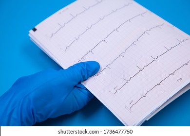 ECG Strip Given By Hand In Medical Glove, Blue Background