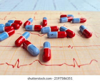 ECG With Ventricular Pacing Rhythm Of Artificial Pacemaker With Pills On Table. Cardiovascular Diseases And Heart Treatment