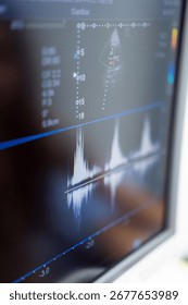 Echocardiogram analysis shown on screen. An echocardiogram result is shown on a monitor, showcasing heart activity with various waveforms and measurements.