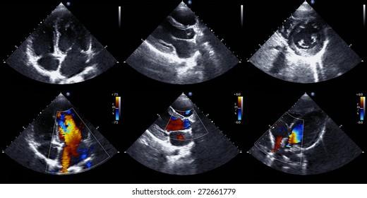 Echocardiography set of patterns