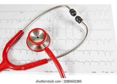 Ecocardiography Report (ECG) Showing Irregular Heartbeat With  A Red Stethoscope On Top Of It