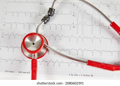 Ecocardiography Report (ECG) Showing Irregular Heartbeat With  A Red Stethoscope On Top Of It