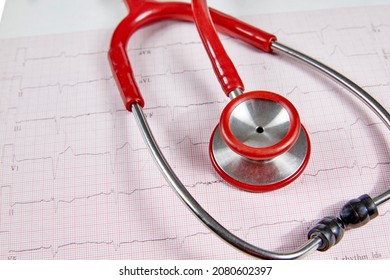 Ecocardiography Report (ECG) Showing Irregular Heartbeat With  A Red Stethoscope On Top Of It