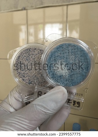 E.coli bacteria and coliform bacteria present in water