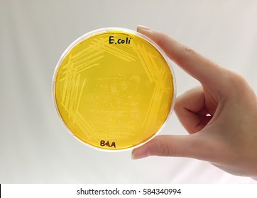  E.coli Culture On Brilliant Green Agar (BGA  Agar) 