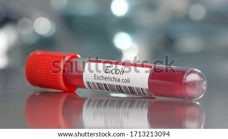 E.coli Escherichia coli antibodies vial in medical lab