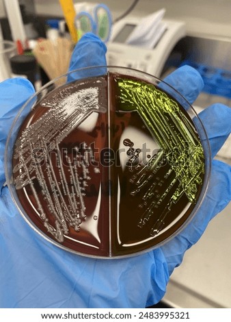E.coli on EMB Agar and Macconkey Agar