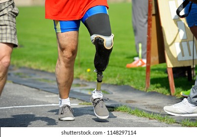 Editorial use only. Artificial leg of disabled athlete running on a track. Trials among disabled Ukrainian soldiers to the 43 rd US Marine Corps marathon. July 20, 2018. Kiev, Ukraine