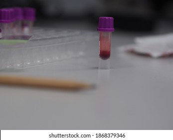 Edta Blood Images Stock Photos Vectors Shutterstock