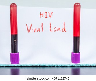 EDTA Blood  Tube For Viral Load Test In Laboratory.