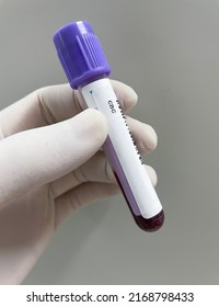 EDTA test tube Anticoaglant CBC test.Blood sample.