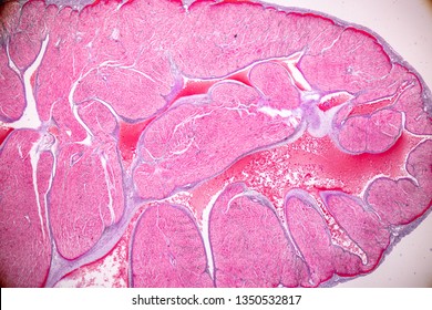 Education Anatomy And Histological Sample Heart Muscle Tissue Under The Microscope.