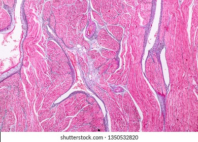 Education Anatomy And Histological Sample Heart Muscle Tissue Under The Microscope.