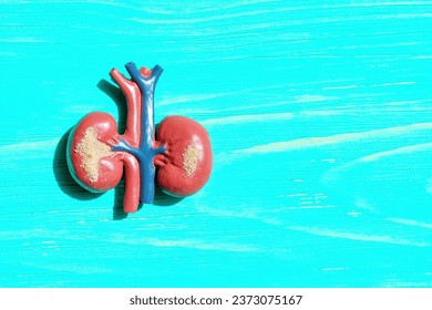 Educational model displaying human kidneys with sand-like particles, representing kidney ailments and medical conditions.