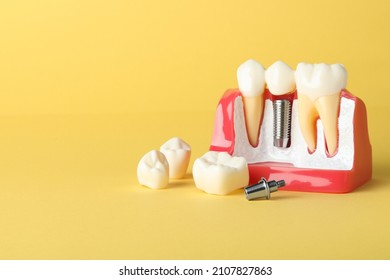 Educational model of gum with dental implant between teeth on yellow background. Space for text