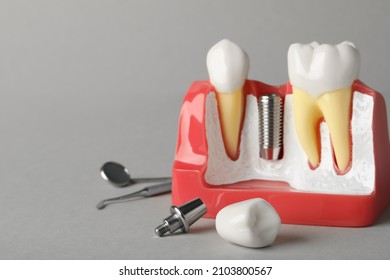 Educational model of gum with post for dental implant between teeth and crown on grey background
