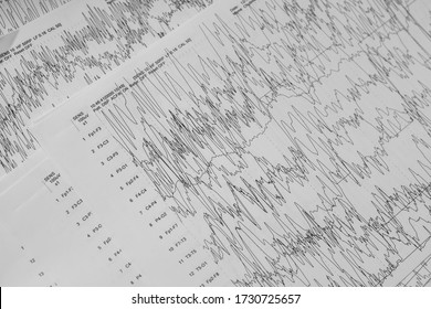 EEG Of The Pediatric Patients, Problems In The Electrical Activity Of The Brain.Abnormal EEG.