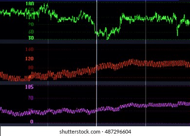 EEG Wave - Powered by Shutterstock - Get 15% off with code: PIKWIZARD15