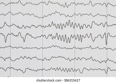 EEG Wave Background.