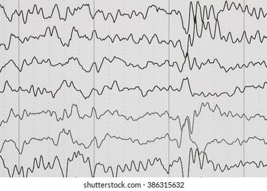 EEG Wave Background.