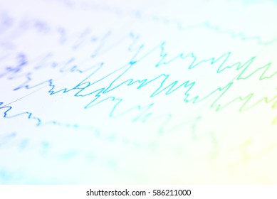 Eeg Wave Backgroundbackground Abnormal Eegbrain Wave Stock Photo ...