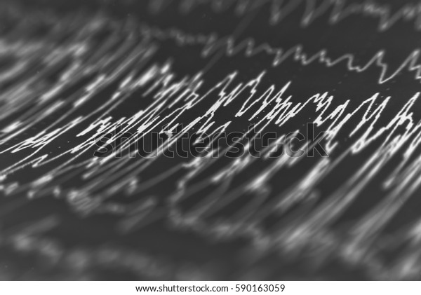 Eeg Wave Backgroundbackground Abnormal Eegbrain Wave Stock Photo (Edit ...