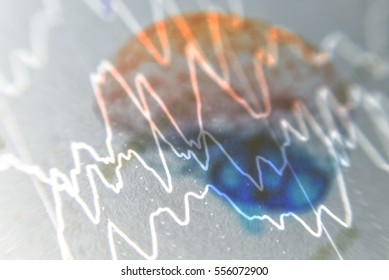 EEG Wave Background,Brain With Brain Wave