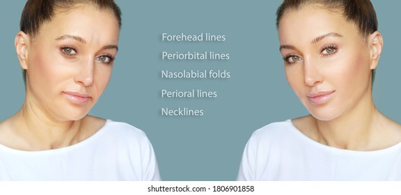 Effects of ageing,Frown/scowl lines ,Nasolabial folds,Neck ,Under eye circles,neck lines. Plastic Surgery Results - Shutterstock ID 1806901858