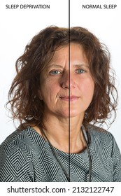 Effects Of Sleep Deprivation On A Woman's Face, Comparison Before And After Sleep Deprivation And Normal Rest