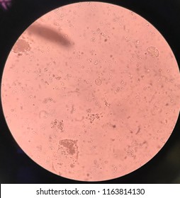 Egg of Entamoeba coli in stool on the microscopic Stock Photo