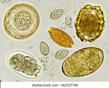 Egg of helminth in stool, analyze by microscope
