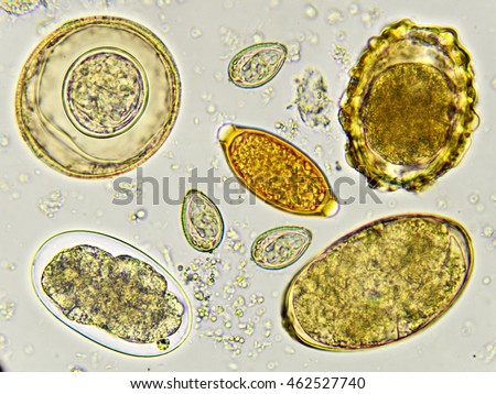 Egg of helminth in stool, analyze by microscope
