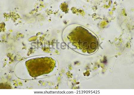 Egg of Hookworm in human stool, analyze by microscope, original magnification 400x