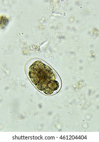 Egg of Hookworm in stool, analyze by microscope