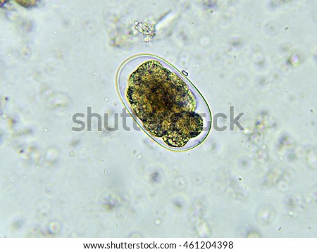 Egg of Hookworm in stool, analyze by microscope