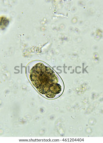 Egg of Hookworm in stool, analyze by microscope