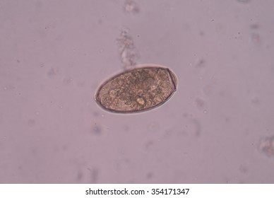 Egg Parasite Stool Exam Stock Photo 354171347 | Shutterstock