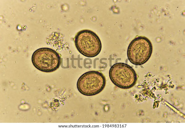 Egg Taenia Tapeworm Human Stool Analyze Stock Photo 1984983167 ...