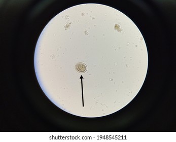 Roundworm Bilder Stockfotos Und Vektorgrafiken Shutterstock