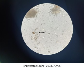 Eggs of Entamoeba coli cyst  in stool, analyze by microscope. Stock Photo