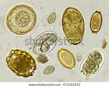 Eggs of helminth in stool, analyze by microscope